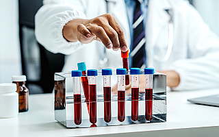 W Elblągu zabrakło hematologa. Poradnia szuka specjalistów W Elblągu zabrakło hematologa. Poradnia szuka specjalistów